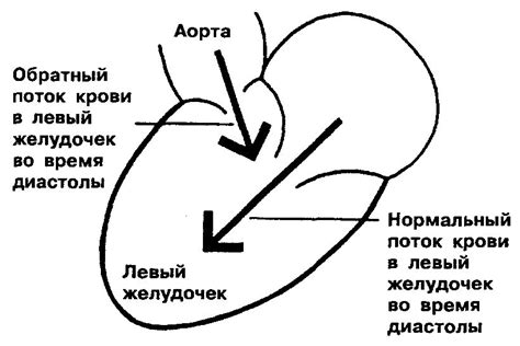 Потенциальные опасности при повышенном пульсовом давлении