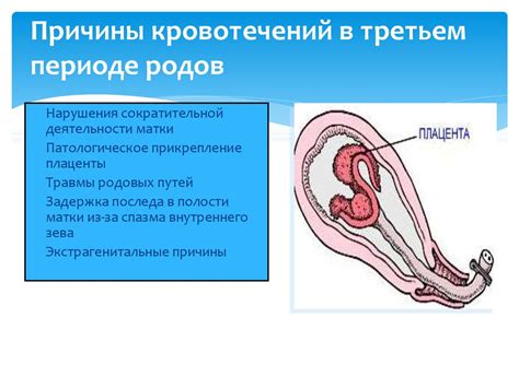 Потенциальные причины возникновения значительных кровотечений после родов