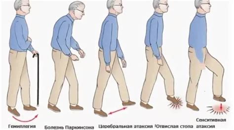 Потеря координации движений