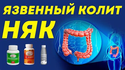 Почему болит кишечник утром?