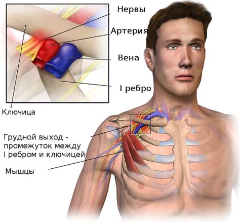 Почему болит правая ключица?