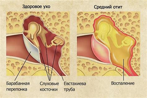 Почему возникает боль в ухе при глотании у ребенка?