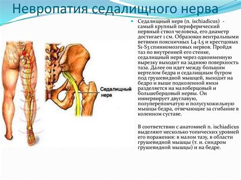 Почему возникает защемление седалищного нерва при грыже позвоночника?