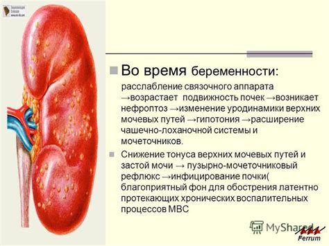 Почему возникает избыточная подвижность почек