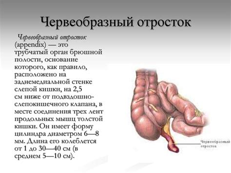 Почему возникает невизуализация червеобразного отростка?