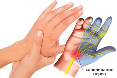 Почему возникает онемение после резки пальца?