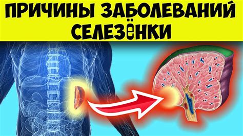 Почему возникают неровности контуров селезенки?