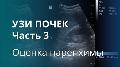 Почему зона повышенной эхогенности имеет значение