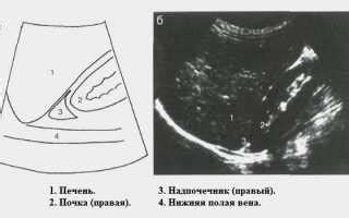 Почему надпочечник не видно на УЗИ: причины