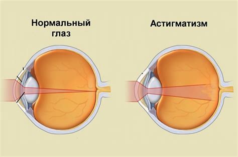 Почему надулся глаз и как это происходит?