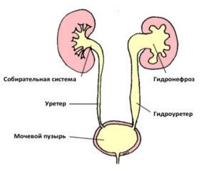 Почему не видны мочеточники