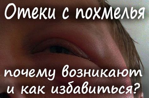 Почему не спится после пьянки?