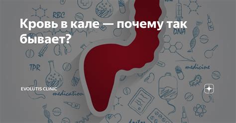 Почему появляется кровь в кале?