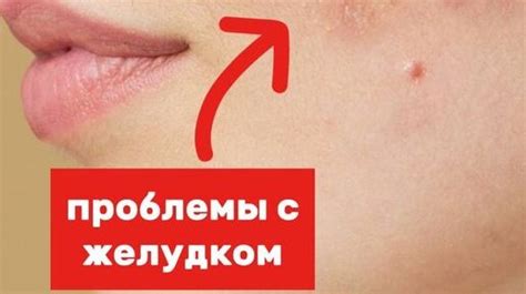 Почему прыщ на седалище может стать объектом психоанализа?