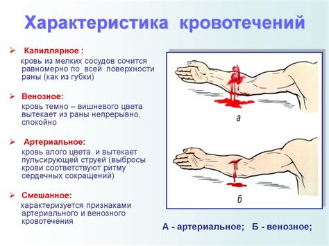 Почему снится ранение осколком и истечение крови из ноги: факторы и интерпретация