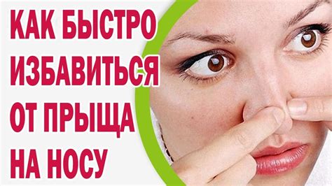 Почему удар пальцем по носу опасен?