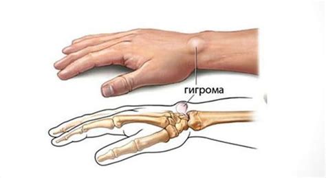 Почему чешется запястье правой руки: причины и значения