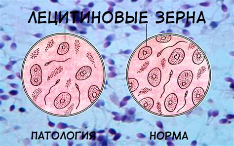 Практические рекомендации для компенсации отсутствия лецитиновых зерен