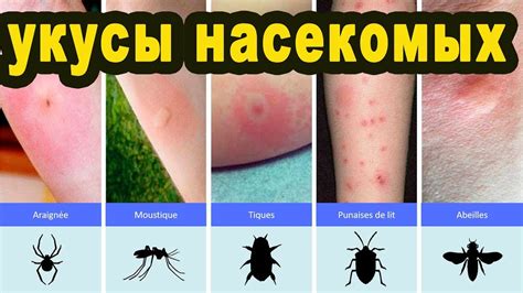 Практические рекомендации для предупреждения укусов грызунов и справление с их последствиями