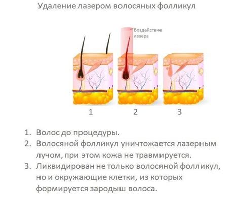 Практическое значение сновидений о удалении волос с усов: действия, которые можно предпринять