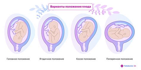 Предлежание головки при беременности: понятие и значение