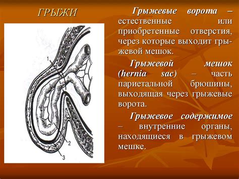 Предотвращение возникновения грыжи