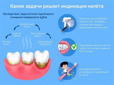 Предотвращение образования зубного налета и зубного камня