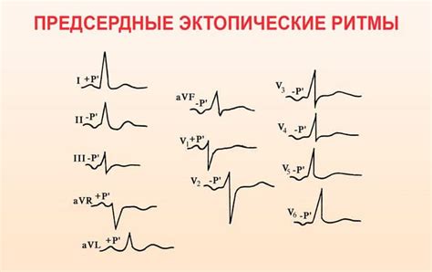 Предсердный ритм у детей: причины, симптомы и лечение