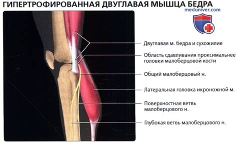 Предупреждение гипертрофированной мансипамы