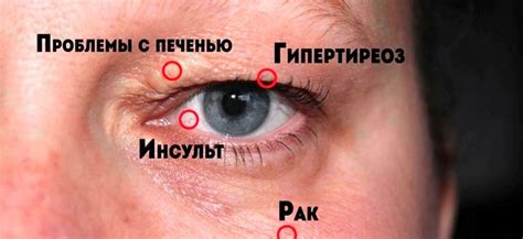 Предупреждение о предстоящей опасности: подсознательные сигналы левого глаза в субботу