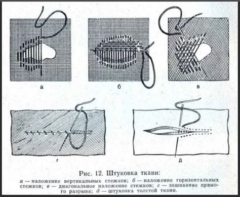 Преимущества использования подкладки иголкой с ниткой