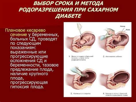 Преимущества и недостатки естественного метода родоразрешения при рождении тройни