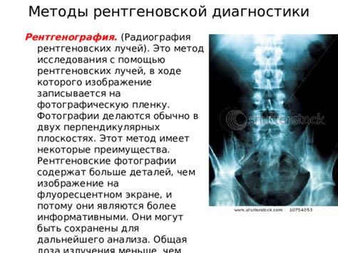 Преимущества и недостатки рентгеновской диагностики легких