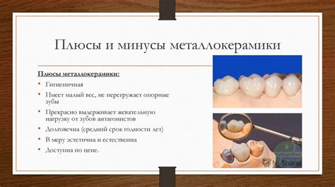 Преимущества литых коронок перед другими видами