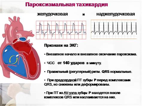 Преимущества небиволола при тахикардии