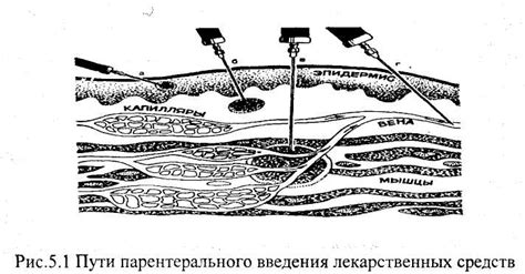 Преимущества парентерального введения лекарства