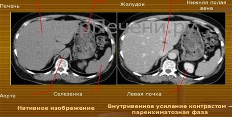 Признаки кист правой доли печени: общая информация