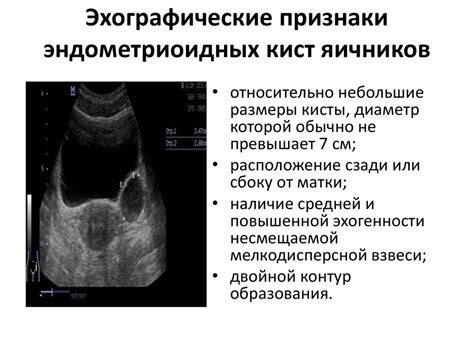 Признаки кист эндоцервикальной зоны