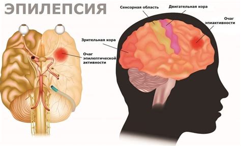 Признаки потери головы: физические и психические симптомы