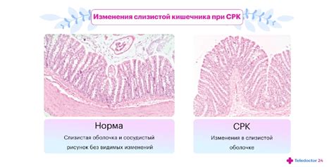 Признаки раздраженного состояния