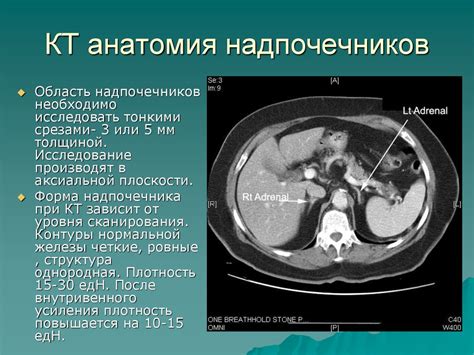 Применение КТ исследования в диагностике заболеваний