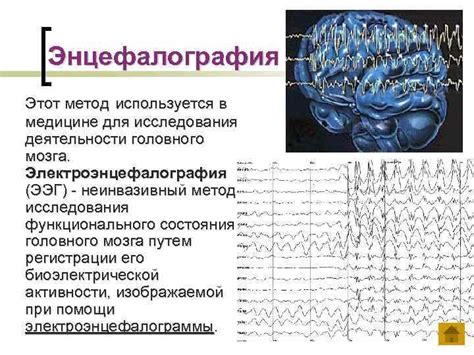 Применение патологического ЭЭГ в медицине