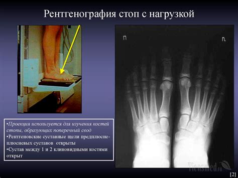 Применение рентген стоп с нагрузкой в медицине