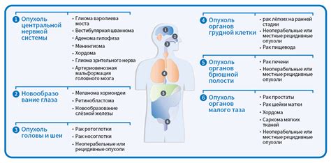 Примеры инвазивных видов рака: полезная информация