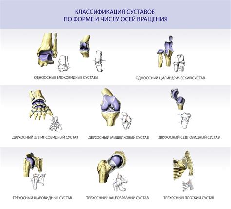 Примеры комбинированных суставов