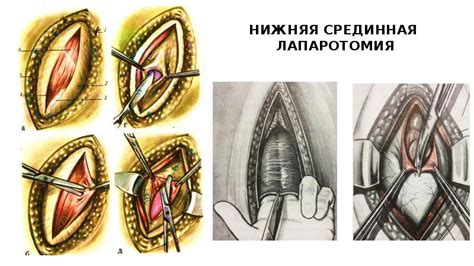 Принципы оперативной гинекологии