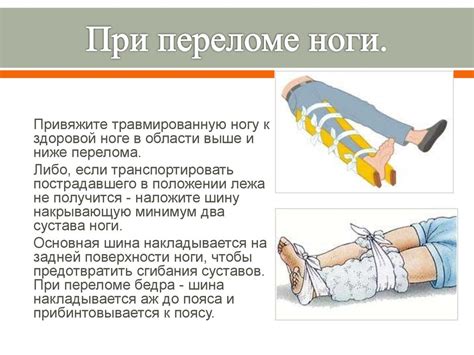 Принципы первой помощи при переломе ноги