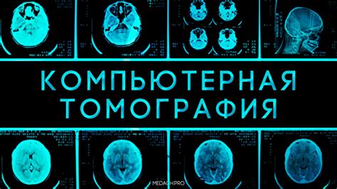 Принципы работы компьютерной томографии с контрастом: