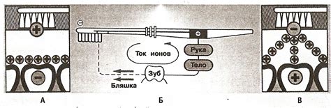 Принцип работы ионной зубной щетки