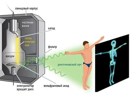 Принцип работы рентген 2 проекций